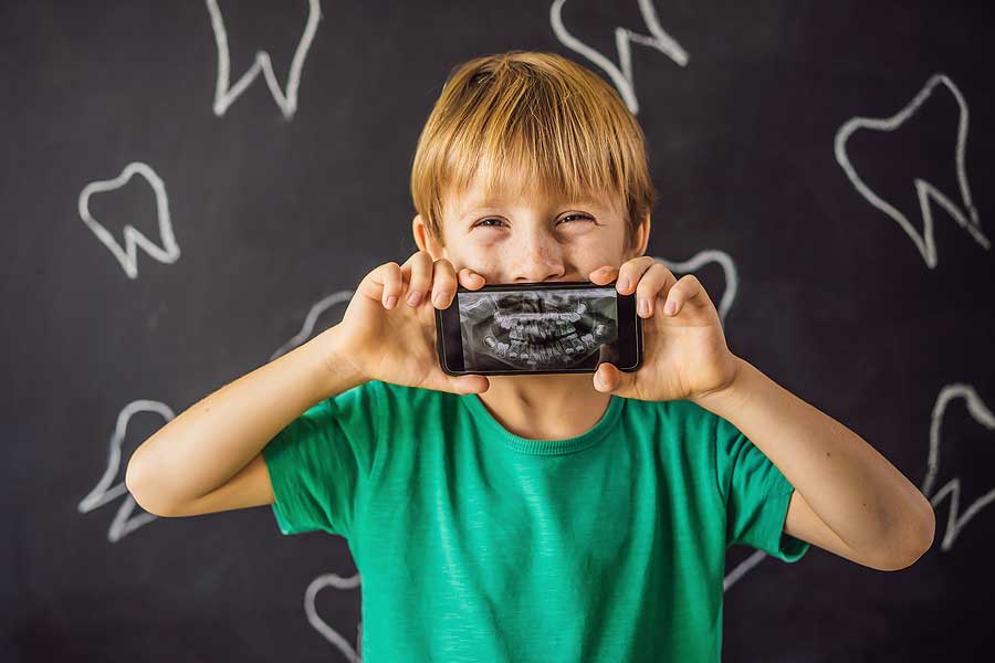 young boy holding up an X-ray of his mouth showing extra tooth